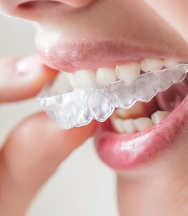 Invisalign